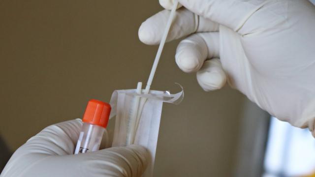 PCR test