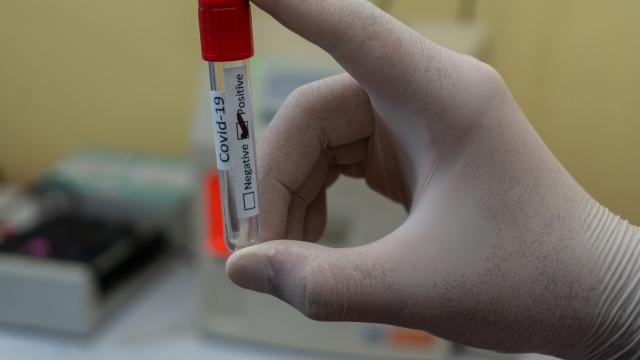 PCR test